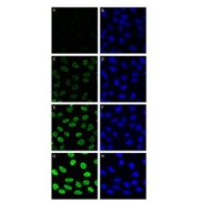 Неокарзиностатин из Streptomyces carzinostaticus 90% (SDS-PAGE), ~ 0,5 мкг / мл Sigma N9162